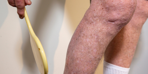 Checking skin for changes